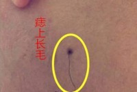 痣上长毛的风水好吗？有什么意义？
