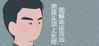 男孩头上有痣，命运吉凶